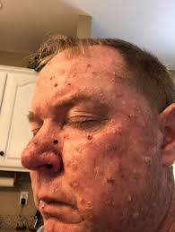 I was a non believer!! : r/CBD