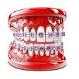 Braces product image