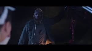 Bloody Axe Wound - Billy Burke Fans