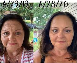 GREENSBEST hydrolyzed collagen peptides 5 Benefits of Collagen 1) Reduces  Joint Pain and Support Joint Function 2) Supports Healthy Skin for glowing  and youth regeneration 3) Repairs Leaky Gut, seals the lining