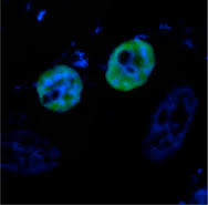 From reliable residential and commercial collection to our impressive recycling centers to our environmentally sound landfills and transfer stations, we are dedicated to excellent customer service and waste prevention. Elucidation Of The Role Of Non Structural Viral Protein W Of Newcastle Disease Virus International Journal Of Infectious Diseases