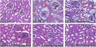 Aqueous Garlic Extract Improves Renal Clearance Via Vasodilatory Antioxidant Mechanisms And Mitigated Proteinuria Via Stabilization Of Glomerular Filtration Barrier Clinical Phytoscience Full Text