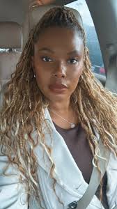 Alopecia awareness month interview