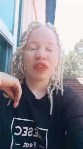 justblondy #goviralgo#albino