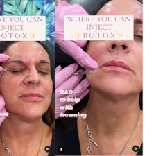 YOUTHFUL SOLUTIONS MEDISPA AND WELLNESS