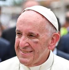 Nell' #eucaristia la fragilità è forza: Papa Francesco Piccolo Incidente Sulla Papamobile