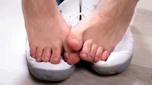 4 Ways You Can Avoid Stinky Feet Health Essentials From Cleveland Clinic