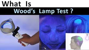 what is woods lamp test