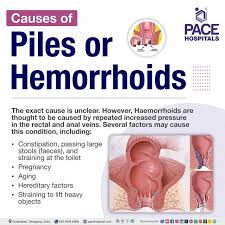 Image result for hemorrhoids