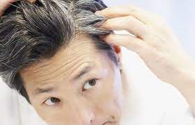 Penyebab rambut beruban yang sangat umum adalah pertambahan usia. Muda Muda Pun Rambut Beruban Ketahui Punca Cara Elak Rambut Beruban Di Usia Muda