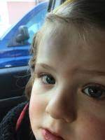 Mann geht mit bauchschmerzen zum arzt: Mit Beule Zum Arzt Forum Kindergartenalter Urbia De