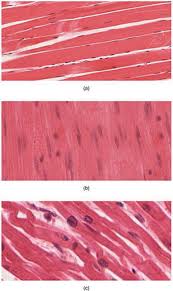 Education anatomy and histological sample striated (skeletal) muscle of mammal tissue under the microscope. Musculoskeletal Injuries Types And Management Protocols For Emergency Care Intechopen