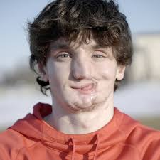 I shot myself in the face