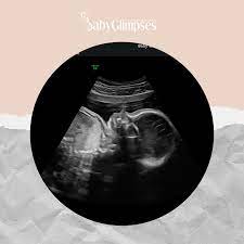 Baby Glimpses Colorado Springs Home Facebook