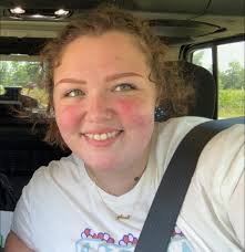 Alternative treatments for psoriasis