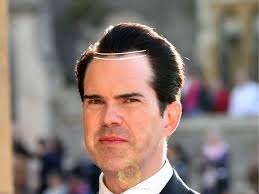 Jimmy Carr Saç Ekimi