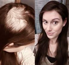 Wigs for women with thinning hair,check wigs for women with thinning hair with top quality at wigsbuy.com. What Are The Best Hairstyles For Very Thin Hair Hair Adviser