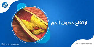 Pin On عمليات