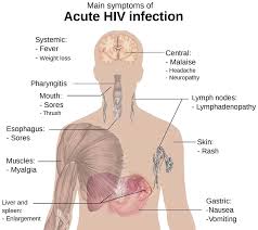 Image result for Paresthesia