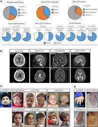 Ramsey size özel fiyat, indirim ve kampanyalarla birlikte hepsiburada.com'da. Partial Loss Of Usp9x Function Leads To A Male Neurodevelopmental And Behavioral Disorder Converging On Transforming Growth Factor B Signaling Biological Psychiatry