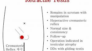 Image result for Cremasteric Reflex