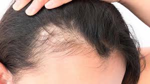 Full of beneficial minerals and vitamins, such as vitamins a and c, and iron. 6 Cheap Natural Hair Growth Vitamins With Incredible Reviews And Reputations Shefinds
