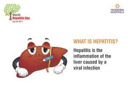 You won't be able to see the symptoms of hepatitis every time, so beware. World Hepatitis Day Eliminating Hepatitis Through Awareness