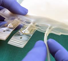 Image result for Apheresis