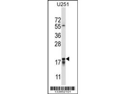 The tpod, and commercial hrp for comparison, enzymes were conjugated to ac iggs using 1%, 5% and 10% glutaraldehyde. Anti Camel Antibody Products Biocompare