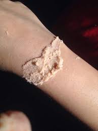 Maybe you would like to learn more about one of these? How To Make Diy Scar Wax Without Vaseline