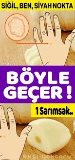 Sigil Siyah Nokta Ben Ve Yaslilik Lekelerini Geciren Formul Health Eye Care Diet And Nutrition