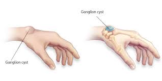 Pin On Medical