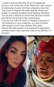 Justice for woman allegedly burned by her partner