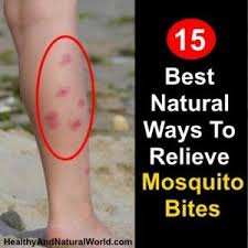 Bug Bites That Look Like Mosquito Bites But Hurt The Most Effective And Natural Ways To Relieve Mosquito Bites Fast Bug Bites Remedies Remedies For Mosquito Bites Mosquito