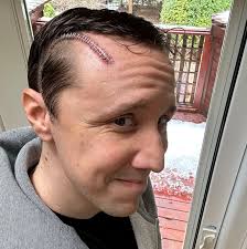 The second I accepted a brain tumour might kill me…everything got better.