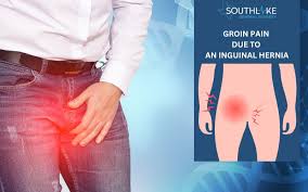 Image result for sore skin in the groin area