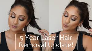 Lasers heat hair to damage the stem cells in hair follicles, but if the hair is too long, the laser can burn your skin. 5 Year Full Body Laser Hair Removal Update Makeup By Megha Youtube