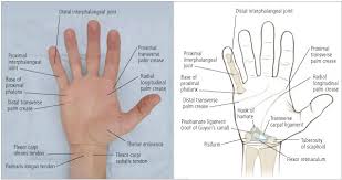 Right common flexor sheath ulnar bursa. Hand And Wrist Injuries Part I Nonemergent Evaluation American Family Physician