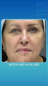 José Raúl Montes Eyes & Facial Rejuvenation