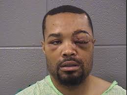 Man shot by DEA agent in 2014 files lawsuit