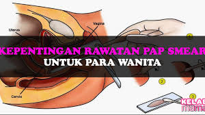Learn what a pap smear test is and how to interpret the results, including what an ascus result means and how it relates to cervical cancer. Kepentingan Rawatan Pap Smear Untuk Setiap Wanita May 2021 Kelabmama Malaysia