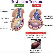 Image result for Cremasteric Reflex