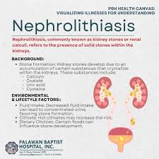 Image result for Calcium Nephrolithiasis