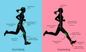 Image result for Running Injury