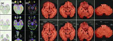 In stock for fast and free delivery. A Color Maps Are Shown At The Compartment Level Of The Brain Stem Download Scientific Diagram