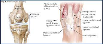 Front leg pathologies a) knee hygroma b) tendinitis (bowed tendon). Traumatic Patellar Dislocation Hughston Clinic
