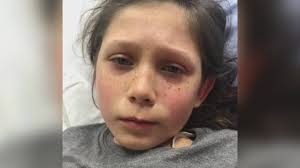 B.C. 19-year-old hospitalized with rare COVID-linked syndrome usually found  in kids