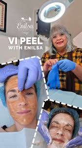 Hello everyone 🥰 My friend and marketing person Tina came back for a  second peel and recorded some of the process so we could share it online  with you guys 💕 This is her second peel, she had her ...