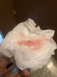 Sangramento de nidação rosa claro | BabyCenter