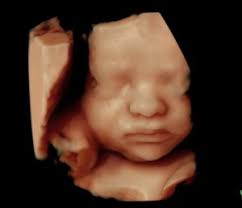 Maybe you would like to learn more about one of these? 3d 4d Ultrasound Denver The Only 700 Google Reviews 5 Star Rated 3d 4d Hd Prenatal Ultrasound Center In Colorado